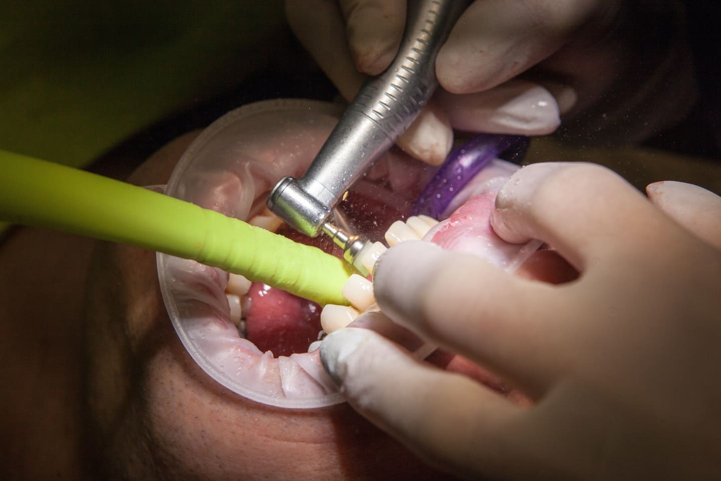 Andrzej Suchanek - Gabinet Dentystyczny - Endodoncja Chorzów